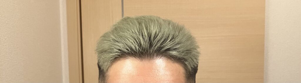 ブリーチ後に時間が経って緑っぽく色落ちした髪色。少しくすんだ明るめのグリーン。